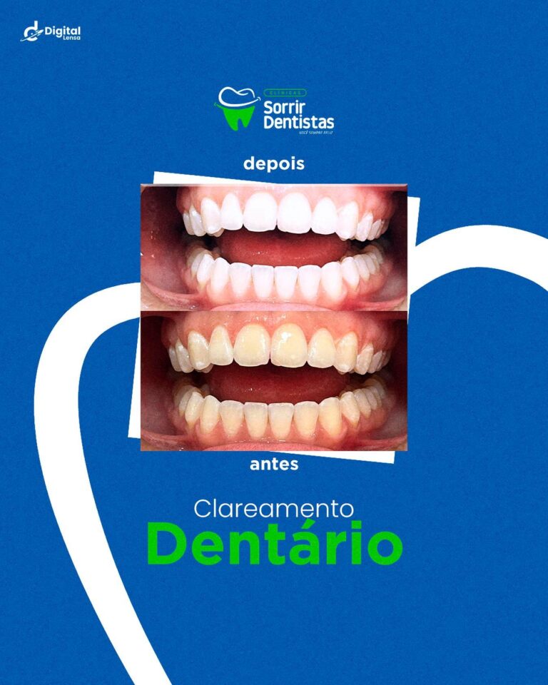 sorrirdentistasvrb_366104357_794340056025096_2694752233385996580_n